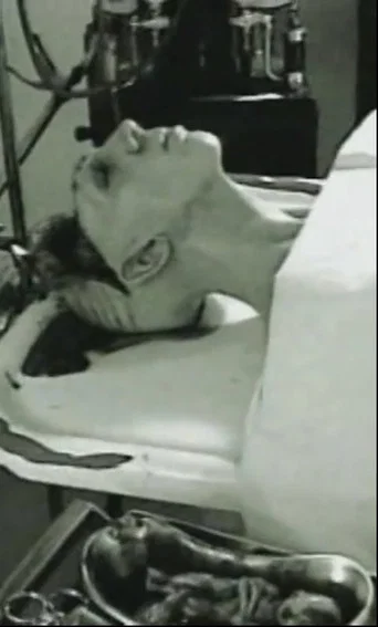 Autopsy poster